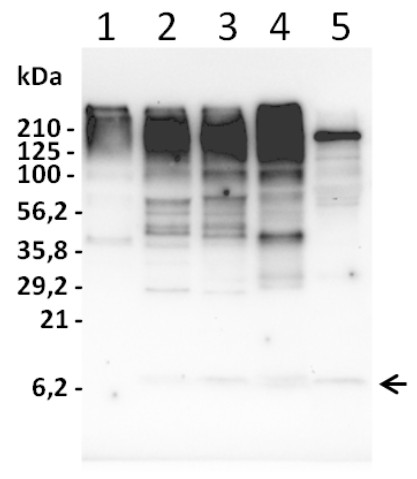 Western blot using anti-ubiquitin antibodies